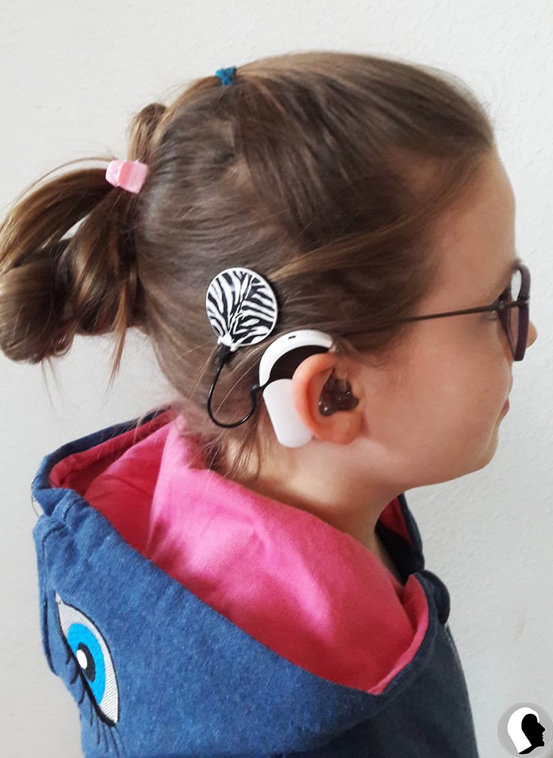 CI Kopf 2018 weiblich Kind